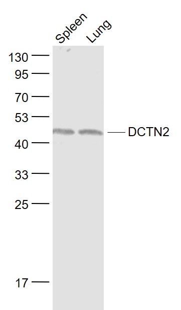 Lane 1: Mouse Spleen lysates; Lane 2: Mouse Lung lysates probed with DCTN2 Polyclonal Antibody, Unconjugated (bs-7836R) at 1:1000 dilution and 4˚C overnight incubation. Followed by conjugated secondary antibody incubation at 1:20000 for 60 min at 37˚C.