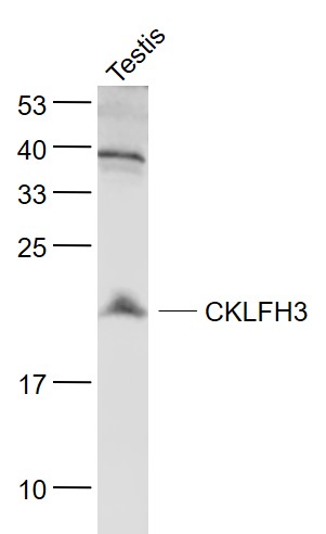 Lane 1: Testis lysates probed with CKLFH3 Polyclonal Antibody, Unconjugated (bs-8021R) at 1:1000 dilution and 4˚C overnight incubation. Followed by conjugated secondary antibody incubation at 1:20000 for 60 min at 37˚C.