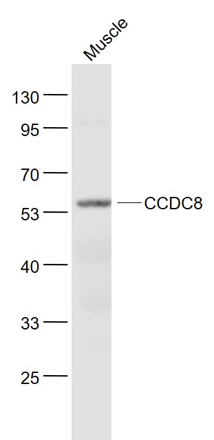 Lane 1: muscle lysates probed with CCDC8 Polyclonal Antibody, Unconjugated (bs-8138R) at 1:1000 dilution and 4˚C overnight incubation. Followed by conjugated secondary antibody incubation at 1:20000 for 60 min at 37˚C.