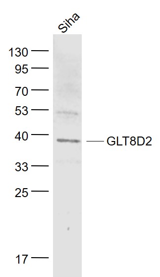 Lane 1: Siha cell lysates probed with GLT8D2 Polyclonal Antibody, Unconjugated (bs-8302R) at 1:1000 dilution and 4˚C overnight incubation. Followed by conjugated secondary antibody incubation at 1:20000 for 60 min at 37˚C.