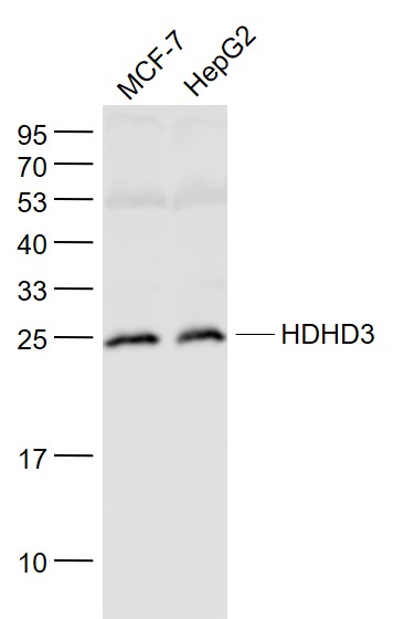Lane 1: MCF-7 cell lysates; Lane 2: HepG2 cell lysates probed with HDHD3 Polyclonal Antibody, Unconjugated (bs-8318R) at 1:1000 dilution and 4˚C overnight incubation. Followed by conjugated secondary antibody incubation at 1:20000 for 60 min at 37˚C.