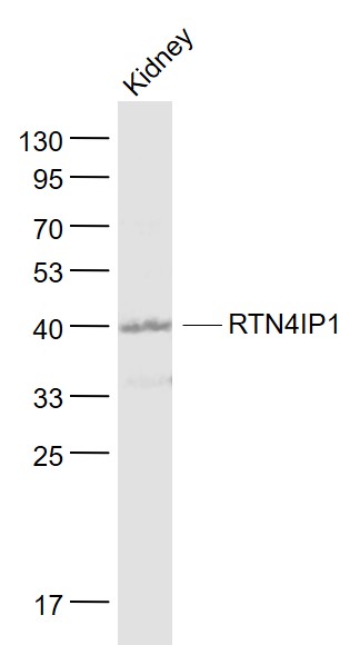Lane 1: Kindey lysates probed with NIMP Polyclonal Antibody, Unconjugated (bs-8334R) at 1:1000 dilution and 4˚C overnight incubation. Followed by conjugated secondary antibody incubation at 1:20000 for 60 min at 37˚C.