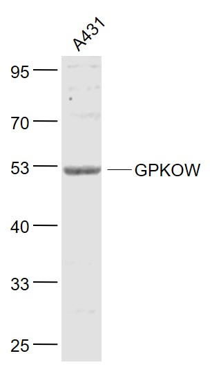 Lane 1: A431 cell lysates probed with GPKOW Polyclonal Antibody, Unconjugated (bs-8577R) at 1:1000 dilution and 4˚C overnight incubation. Followed by conjugated secondary antibody incubation at 1:20000 for 60 min at 37˚C.
