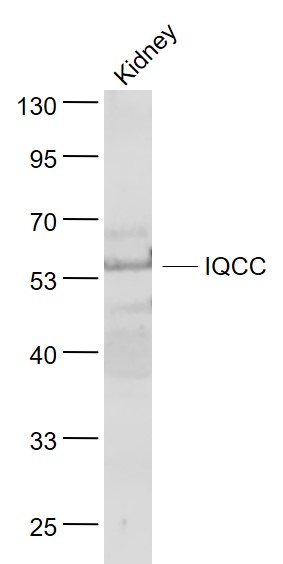 Lane 1: Kindey lysates probed with IQCC Polyclonal Antibody, Unconjugated (bs-9019R) at 1:1000 dilution and 4˚C overnight incubation. Followed by conjugated secondary antibody incubation at 1:20000 for 60 min at 37˚C.