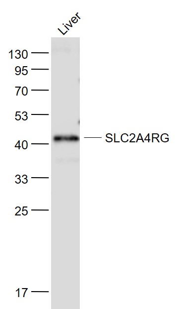 Lane 1: Liver lysates probed with SLC2A4RG Polyclonal Antibody, Unconjugated (bs-9457R) at 1:1000 dilution and 4˚C overnight incubation. Followed by conjugated secondary antibody incubation at 1:20000 for 60 min at 37˚C.