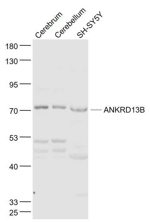 Lane 1: Mouse Cerebrum lysates; Lane 2: Mouse Cerebellum lysates; Lane 3: SH-SY5Y cell lysates probed with ANKRD13B Polyclonal Antibody, Unconjugated (bs-9745R) at 1:1000 dilution and 4˚C overnight incubation. Followed by conjugated secondary antibody incubation at 1:20000 for 60 min at 37˚C.