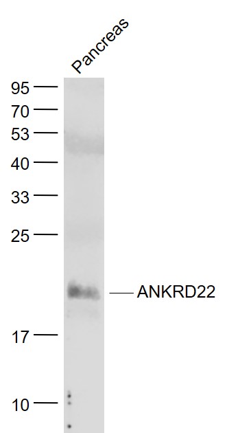Lane 1: Pancreas lysates probed with ANKRD22 Polyclonal Antibody, Unconjugated (bs-9748R) at 1:1000 dilution and 4˚C overnight incubation. Followed by conjugated secondary antibody incubation at 1:20000 for 60 min at 37˚C.