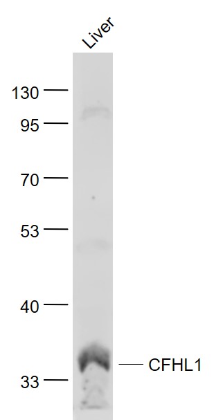 Lane 1: Liver lysates probed with CFHL1 Polyclonal Antibody, Unconjugated (bs-9905R) at 1:1000 dilution and 4˚C overnight incubation. Followed by conjugated secondary antibody incubation at 1:20000 for 60 min at 37˚C.