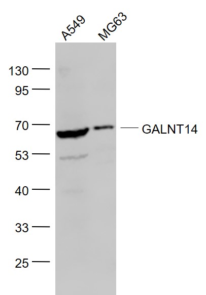 Lane 1: A549 cell lysates; Lane 2: MG63 cell lysates probed with GALNT14 Polyclonal Antibody, Unconjugated (bs-11018R) at 1:1000 dilution and 4˚C overnight incubation. Followed by conjugated secondary antibody incubation at 1:20000 for 60 min at 37˚C.