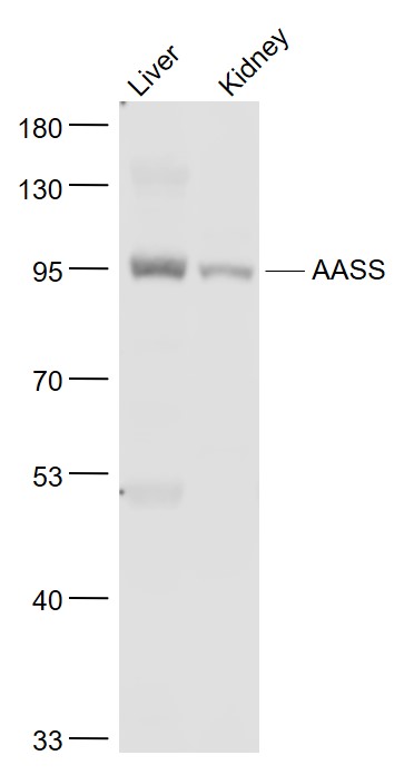 Lane 1: Mouse Liver lysates; Lane 2: Mouse Kindey lysates probed with AASS/LKRSDH Polyclonal Antibody, Unconjugated (bs-11391R) at 1:1000 dilution and 4˚C overnight incubation. Followed by conjugated secondary antibody incubation at 1:20000 for 60 min at 37˚C.