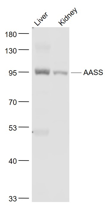 Lane 1: Mouse Liver lysates; Lane 2: Mouse Kindey lysates probed with AASS/LKRSDH Polyclonal Antibody, Unconjugated (bs-11391R) at 1:1000 dilution and 4˚C overnight incubation. Followed by conjugated secondary antibody incubation at 1:20000 for 60 min at 37˚C.