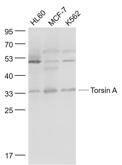 Lane 1: HL60 cell lysates; Lane 2: MCF-7 cell lysates; Lane 3: K562 cell lysates probed with Torsin A Polyclonal Antibody, Unconjugated (bs-11490R) at 1:1000 dilution and 4˚C overnight incubation. Followed by conjugated secondary antibody incubation at 1:20000 for 60 min at 37˚C.