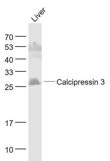 Lane 1: Liver lysates probed with Calcipressin 3 Polyclonal Antibody, Unconjugated (bs-11542R) at 1:1000 dilution and 4˚C overnight incubation. Followed by conjugated secondary antibody incubation at 1:20000 for 60 min at 37˚C.