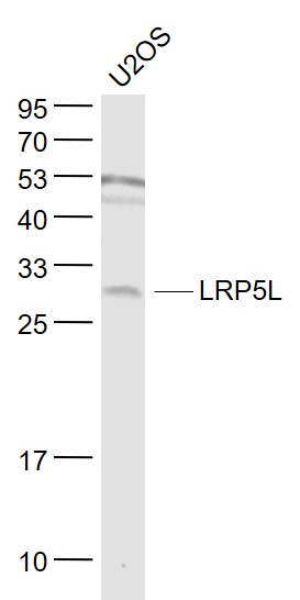 Lane 1: U2os cell lysates probed with LRP5L Polyclonal Antibody, Unconjugated (bs-11590R) at 1:1000 dilution and 4˚C overnight incubation. Followed by conjugated secondary antibody incubation at 1:20000 for 60 min at 37˚C.