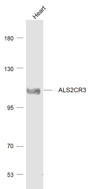 Lane 1: Heart lysates probed with ALS2CR3 Polyclonal Antibody, Unconjugated (bs-11650R) at 1:1000 dilution and 4˚C overnight incubation. Followed by conjugated secondary antibody incubation at 1:20000 for 60 min at 37˚C.