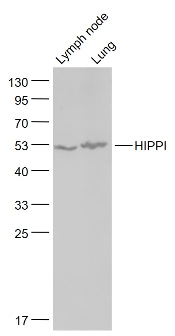 Lane 1: Mouse Lymph node lysates; Lane 2: Mouse Lung lysates probed with HIPPI Polyclonal Antibody, Unconjugated (bs-11697R) at 1:1000 dilution and 4˚C overnight incubation. Followed by conjugated secondary antibody incubation at 1:20000 for 60 min at 37˚C. Lane 1: Mouse Lymph node lysates; Lane 2: Mouse Lung lysates probed with HIPPI Polyclonal Antibody, Unconjugated (bs-11697R) at 1:1000 dilution and 4˚C overnight incubation. Followed by conjugated secondary antibody incubation at 1:20000 for 60 min at 37˚C.