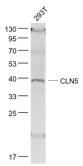Lane 1: 293T cell lysates probed with CLN5 Polyclonal Antibody, Unconjugated (bs-11714R) at 1:1000 dilution and 4˚C overnight incubation. Followed by conjugated secondary antibody incubation at 1:20000 for 60 min at 37˚C.