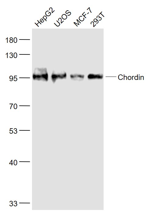 Lane 1: 293T cell lysates; Lane 2: U2os cell lysates; Lane 3: MCF-7 cell lysates; Lane 4: 293T cell lysates probed with Chordin Polyclonal Antibody, Unconjugated (bs-11831R) at 1:1000 dilution and 4˚C overnight incubation. Followed by conjugated secondary antibody incubation at 1:20000 for 60 min at 37˚C.