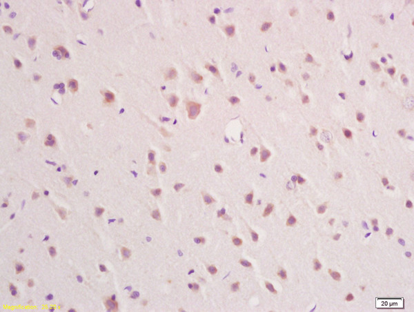 Formalin-fixed and paraffin embedded rat brain labeled with Rabbit Anti IFNAR2/IFNABR Polyclonal Antibody, Unconjugated (bs-7022R) at 1:200 followed by conjugation to the secondary antibody and DAB staining