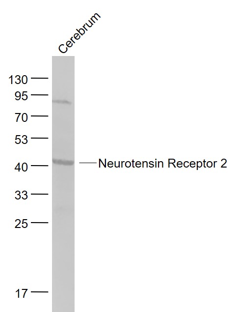 Lane 1: Cerebrum lysates probed with Neurotensin Receptor 2 Polyclonal Antibody, Unconjugated (bs-12004R) at 1:1000 dilution and 4˚C overnight incubation. Followed by conjugated secondary antibody incubation at 1:20000 for 60 min at 37˚C.