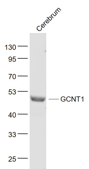 Lane 1: Cerebrum lysates probed with GCNT1 Polyclonal Antibody, Unconjugated (bs-12334R) at 1:1000 dilution and 4˚C overnight incubation. Followed by conjugated secondary antibody incubation at 1:20000 for 60 min at 37˚C.