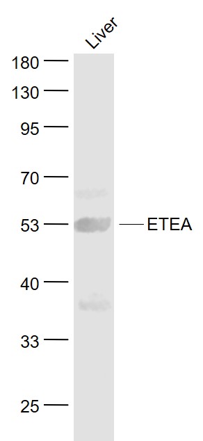 Lane 1: Liver lysates probed with ETEA Polyclonal Antibody, Unconjugated (bs-13109R) at 1:1000 dilution and 4˚C overnight incubation. Followed by conjugated secondary antibody incubation at 1:20000 for 60 min at 37˚C.