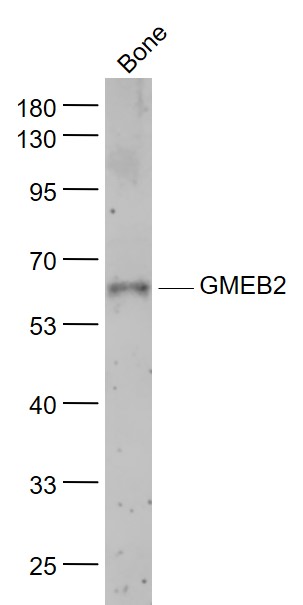Lane 1: Bone lysates probed with GMEB2 Polyclonal Antibody, Unconjugated (bs-13456R) at 1:1000 dilution and 4˚C overnight incubation. Followed by conjugated secondary antibody incubation at 1:20000 for 60 min at 37˚C.