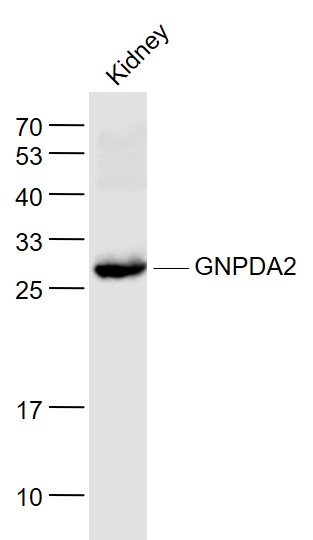 Lane 1: Kindey lysates probed with GNPDA2 Polyclonal Antibody, Unconjugated (bs-13474R) at 1:1000 dilution and 4˚C overnight incubation. Followed by conjugated secondary antibody incubation at 1:20000 for 60 min at 37˚C.