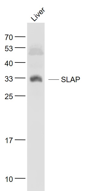 Lane 1: Liver lysates probed with SLAP Polyclonal Antibody, Unconjugated (bs-13668R) at 1:1000 dilution and 4˚C overnight incubation. Followed by conjugated secondary antibody incubation at 1:20000 for 60 min at 37˚C.