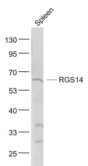 Lane 1: Spleen lysates probed with RGS14 Polyclonal Antibody, Unconjugated (bs-15502R) at 1:1000 dilution and 4˚C overnight incubation. Followed by conjugated secondary antibody incubation at 1:20000 for 60 min at 37˚C.