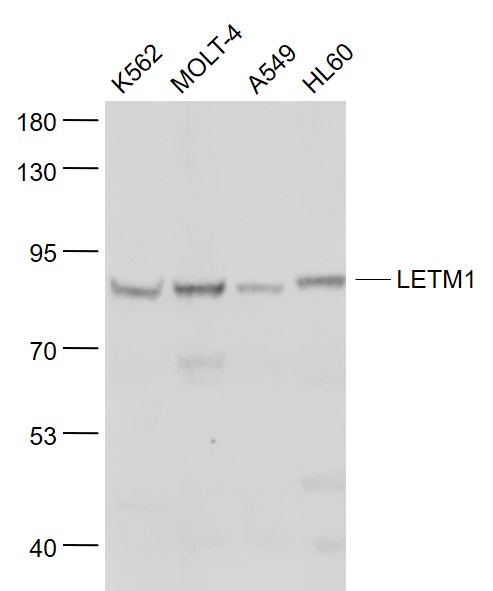 Lane 1: K562 cell lysates; Lane 2: Molt-4 cell lysates; Lane 3: A549 cell lysates; Lane 4:HL60 cell lysates probed with LETM1 Polyclonal Antibody, Unconjugated (bs-15591R) at 1:1000 dilution and 4˚C overnight incubation. Followed by conjugated secondary antibody incubation at 1:20000 for 60 min at 37˚C.