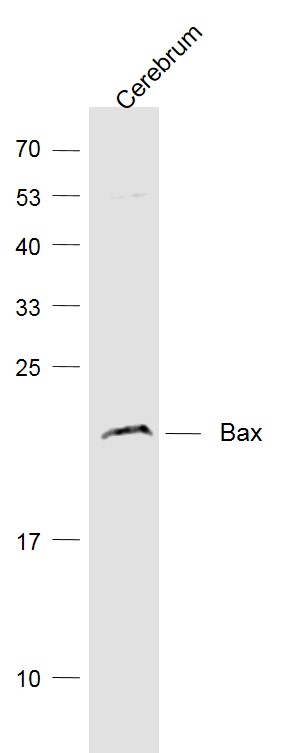 Lane 1: Cerebrum lysates probed with Bax Monoclonal Antibody, Unconjugated (bsm-33279M) at 1:1000 dilution and 4˚C overnight incubation. Followed by conjugated secondary antibody incubation at 1:20000 for 60 min at 37˚C.