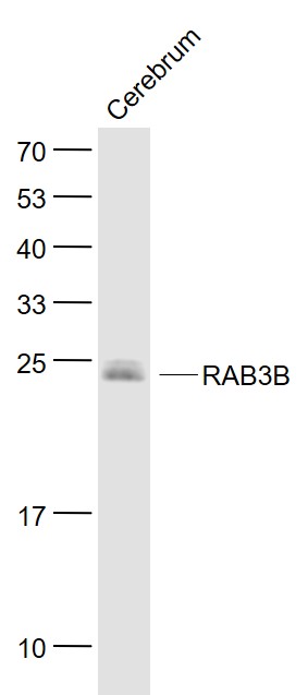 Lane 1: Cerebrum lysates probed with RAB3B (7F5) Monoclonal Antibody, Unconjugated (bsm-51316M) at 1:1000 dilution and 4˚C overnight incubation. Followed by conjugated secondary antibody incubation at 1:20000 for 60 min at 37˚C. Lane 1: Cerebrum lysates probed with RAB3B (7F5) Monoclonal Antibody, Unconjugated (bsm-51316M) at 1:1000 dilution and 4˚C overnight incubation. Followed by conjugated secondary antibody incubation at 1:20000 for 60 min at 37˚C.