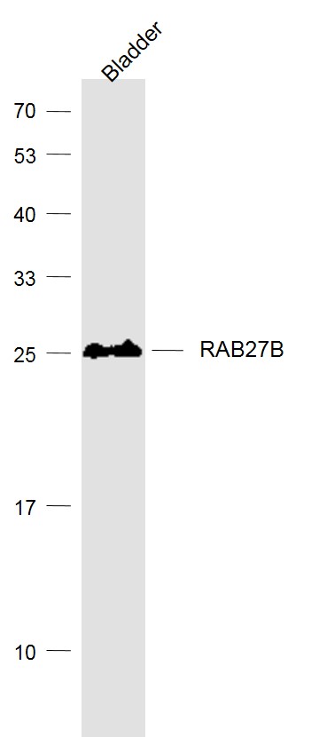 Lane 1: Bladder lysates probed with RAB27B (4G7) Monoclonal Antibody, Unconjugated (bsm-51331M) at 1:1000 dilution and 4˚C overnight incubation. Followed by conjugated secondary antibody incubation at 1:20000 for 60 min at 37˚C.