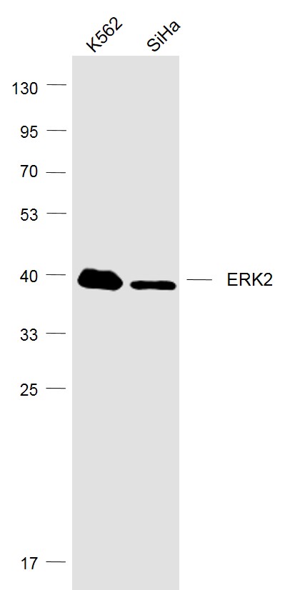 Lane 1: K562 cell lysates; Lane 2: Siha cell lysates probed with ERK2 (3G1) Monoclonal Antibody, Unconjugated (bsm-52068R) at 1:1000 dilution and 4˚C overnight incubation. Followed by conjugated secondary antibody incubation at 1:20000 for 60 min at 37˚C.