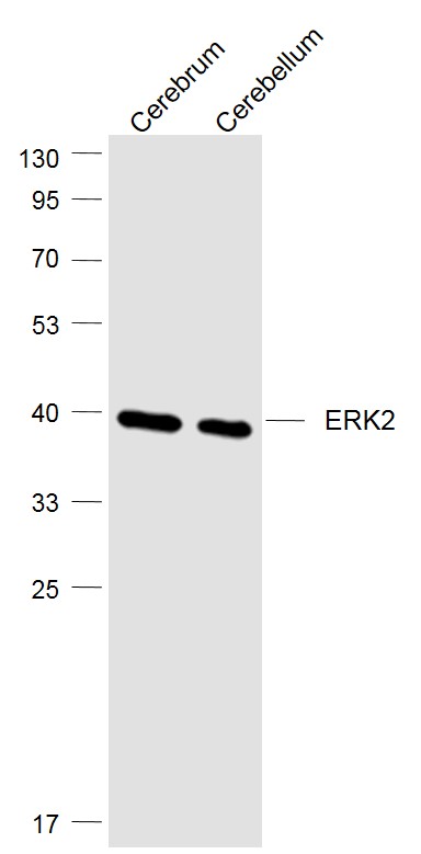 Lane 1: Mouse Cerebrum lysates; Lane 2: Mouse Cerebellum lysates probed with ERK2 (3G1) Monoclonal Antibody, Unconjugated (bsm-52068R) at 1:1000 dilution and 4˚C overnight incubation. Followed by conjugated secondary antibody incubation at 1:20000 for 60 min at 37˚C.