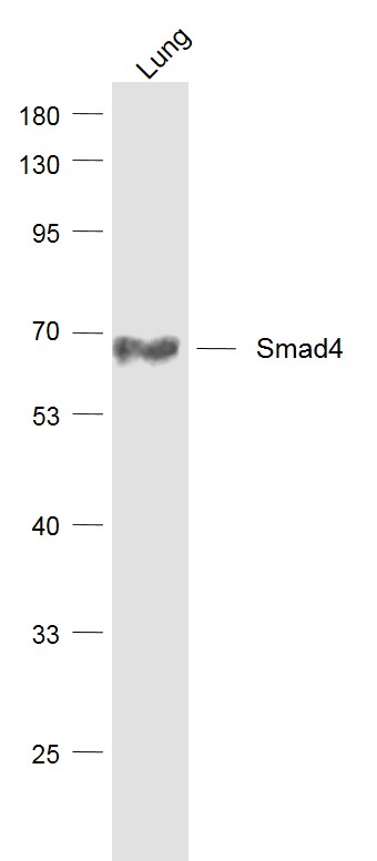 Lane 1: Lung lysates probed with Smad4 (3A1) Monoclonal Antibody, Unconjugated (bsm-52225R) at 1:1000 dilution and 4˚C overnight incubation. Followed by conjugated secondary antibody incubation at 1:20000 for 60 min at 37˚C.