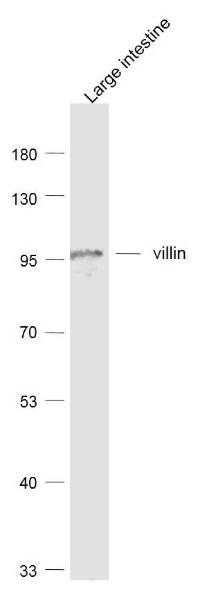 Lane 1: Large intestine lysates probed with Villin-1 (5C1) Monoclonal Antibody, Unconjugated (bsm-54212R) at 1:1000 dilution and 4˚C overnight incubation. Followed by conjugated secondary antibody incubation at 1:20000 for 60 min at 37˚C.