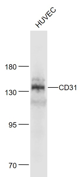 Lane 1: Huvec cell lysates probed with CD31 Polyclonal Antibody, Unconjugated (bs-0468R) at 1:1000 dilution and 4˚C overnight incubation. Followed by conjugated secondary antibody incubation at 1:20000 for 60 min at 37˚C.