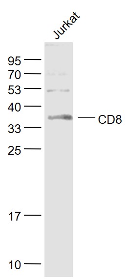 Lane 1: Jurkat cell lysates probed with CD8 Polyclonal Antibody, Unconjugated (bs-0648R) at 1:1000 dilution and 4˚C overnight incubation. Followed by conjugated secondary antibody incubation at 1:20000 for 60 min at 37˚C.