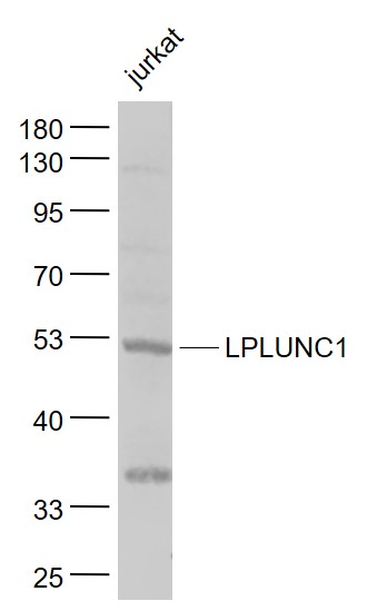 Lane 1: Jurkat cell lysates probed with LPLUNC1 Polyclonal Antibody, Unconjugated (bs-0976R) at 1:1000 dilution and 4˚C overnight incubation. Followed by conjugated secondary antibody incubation at 1:20000 for 60 min at 37˚C.