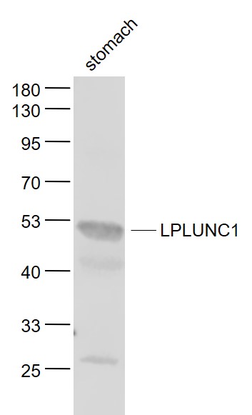 Lane 1: Stomach lysates probed with LPLUNC1 Polyclonal Antibody, Unconjugated (bs-0976R) at 1:1000 dilution and 4˚C overnight incubation. Followed by conjugated secondary antibody incubation at 1:20000 for 60 min at 37˚C.