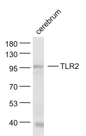 Lane 1: Cerebrum lysates probed with TLR2 Polyclonal Antibody, Unconjugated (bs-1019R) at 1:1000 dilution and 4˚C overnight incubation. Followed by conjugated secondary antibody incubation at 1:20000 for 60 min at 37˚C.