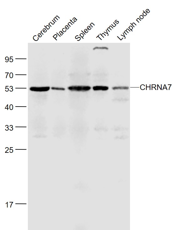 Lane 1: Rat Cerebrum lysates; Lane 2: Mouse Placenta lysates; Lane 3: Mouse Spleen lysates; Lane 4: Mouse Thymus lysates ; Lane 5: Mouse Lymph node lysates probed with CHRNA7 Polyclonal Antibody, Unconjugated (bs-1049R) at 1:1000 dilution and 4˚C overnight incubation. Followed by conjugated secondary antibody incubation at 1:20000 for 60 min at 37˚C.