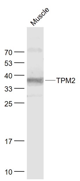 Lane 1: Muscle lysates probed with TPM2 Polyclonal Antibody, Unconjugated (bs-1243R) at 1:1000 dilution and 4˚C overnight incubation. Followed by conjugated secondary antibody incubation at 1:20000 for 60 min at 37˚C.