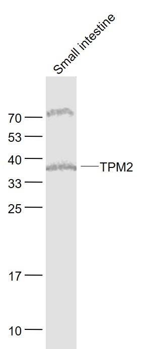 Lane 1: Small intestine lysates probed with TPM2 Polyclonal Antibody, Unconjugated (bs-1243R) at 1:1000 dilution and 4˚C overnight incubation. Followed by conjugated secondary antibody incubation at 1:20000 for 60 min at 37˚C.