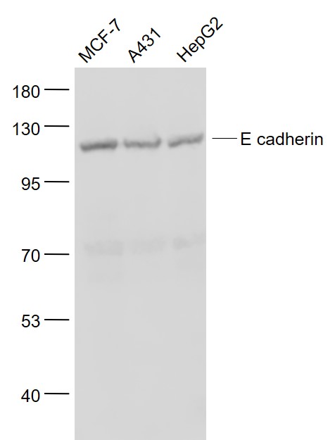 Lane 1: MCF-7 cell lysates; Lane 2: A431 cell lysates; Lane 3: HepG2 cell lysates probed with SIRT4 Polyclonal Antibody, Unconjugated (bs-1519R) at 1:1000 dilution and 4˚C overnight incubation. Followed by conjugated secondary antibody incubation at 1:20000 for 60 min at 37˚C.