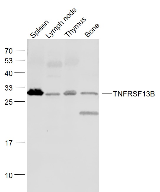 Lane 1: Mouse Spleen lysates; Lane 2: Mouse Lymph node lysates; Lane 3: Mouse Thymus lysates; Lane 4: Mouse Bone lysates probed with TNFRSF13B Polyclonal Antibody, Unconjugated (bs-2773R) at 1:1000 dilution and 4˚C overnight incubation. Followed by conjugated secondary antibody incubation at 1:20000 for 60 min at 37˚C.