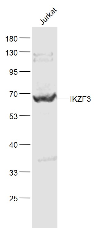 Lane 1: Jurkat cell lysates probed with IKZF3 Polyclonal Antibody, Unconjugated (bs-2954R) at 1:1000 dilution and 4˚C overnight incubation. Followed by conjugated secondary antibody incubation at 1:20000 for 60 min at 37˚C.