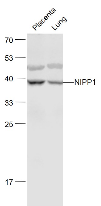Lane 1: Mouse Placenta lysates; Lane 2: Mouse Lung lysates probed with SIRT4NIPP1/ARD1 Polyclonal Antibody, Unconjugated (bs-3658R) at 1:1000 dilution and 4˚C overnight incubation. Followed by conjugated secondary antibody incubation at 1:20000 for 60 min at 37˚C.